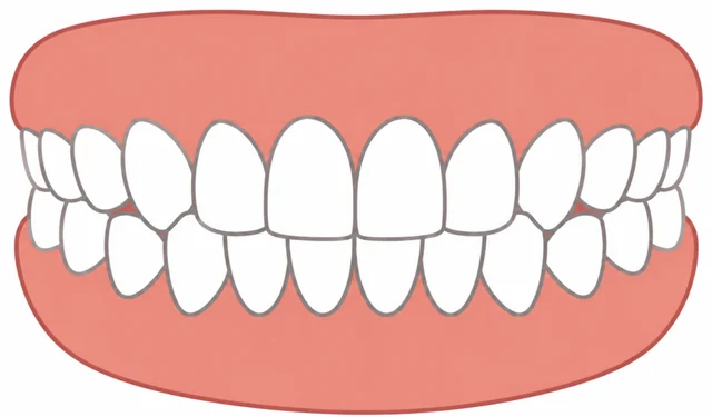 Posterior crossbite