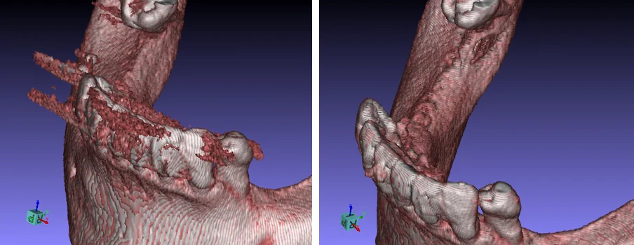 Automatic scatter removal, before and after