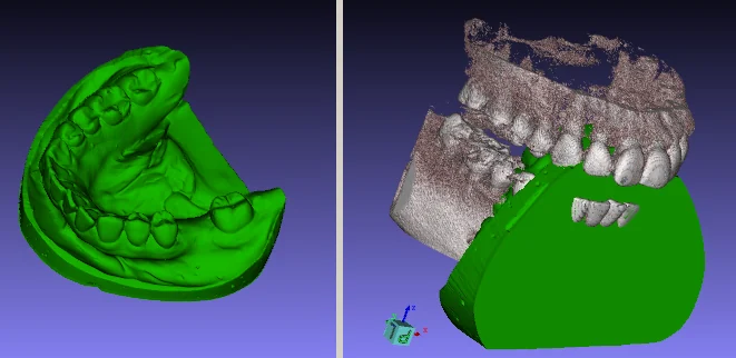 A stone model added to the case
