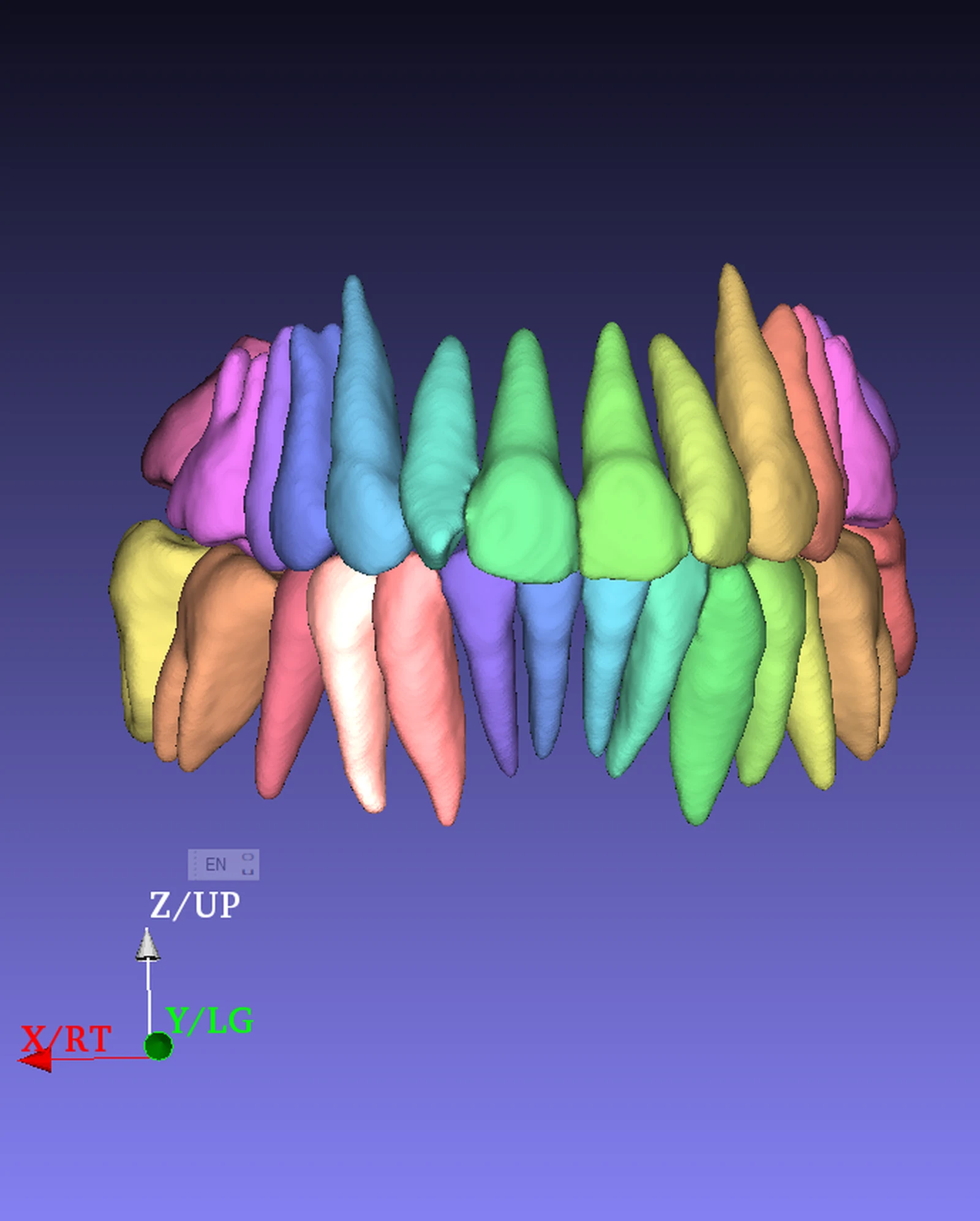 Segmentazione CBCT dente per dente con ogni dente isolato in un colore diverso