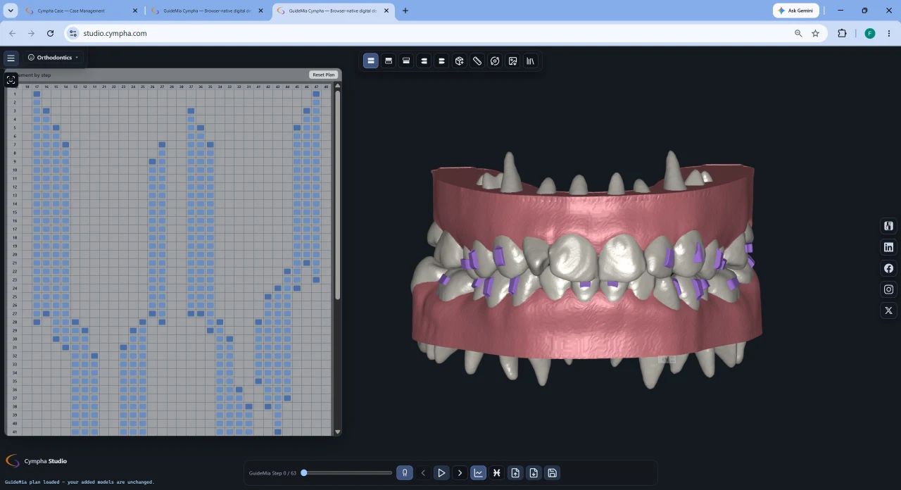 Cympha Studio in un browser, con una griglia di staging degli allineatori accanto a un'arcata 3D con attachment