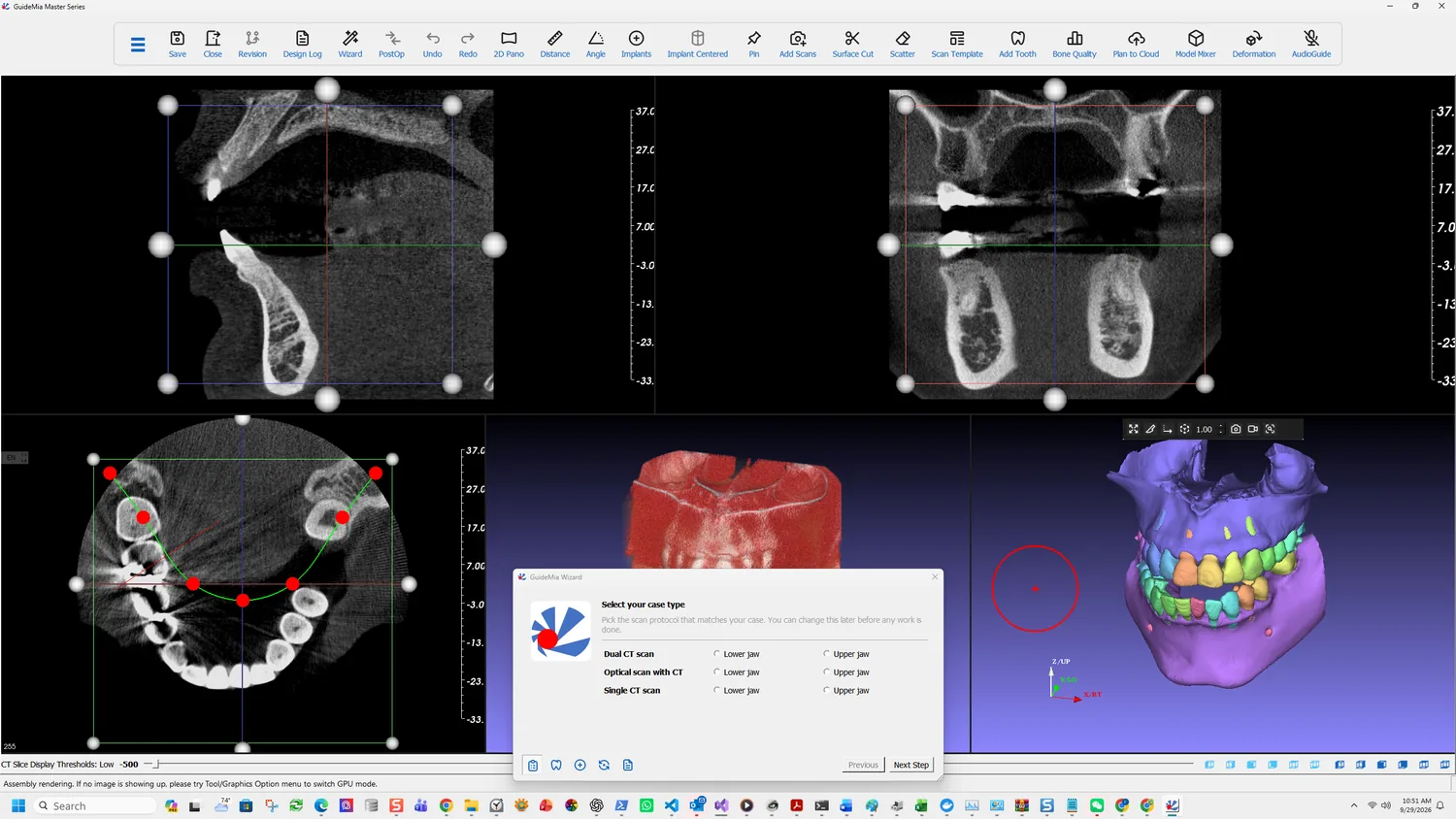 Select your case type, over a workspace where the AI has already segmented the arches