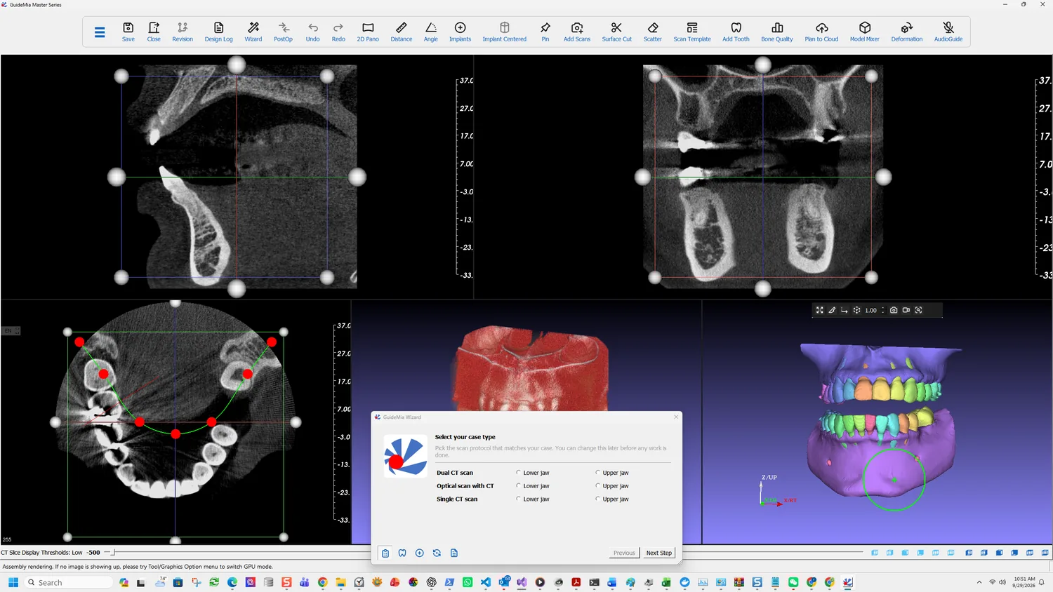 What the AI produced: bone and separated teeth, both arches
