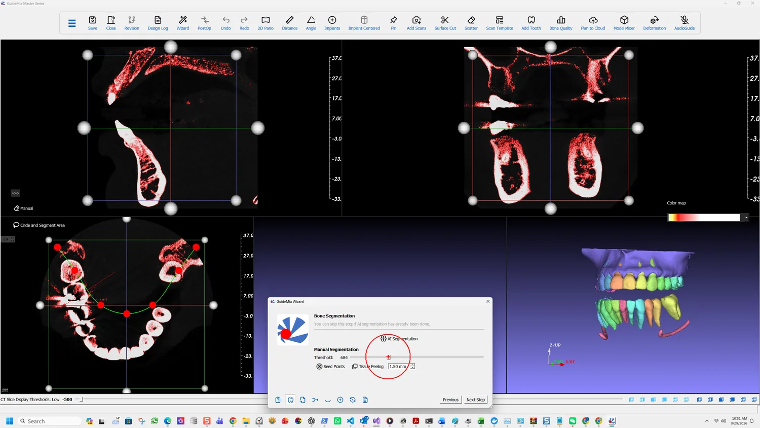 The Bone Segmentation page, with the thresholded voxels shown in red across the slice views