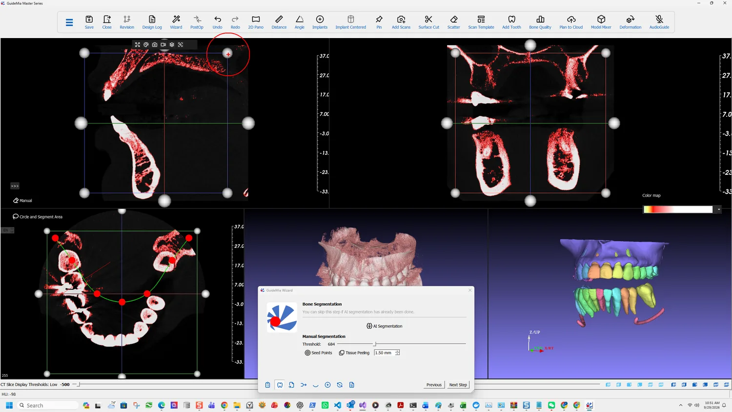 The Bone Segmentation page — AI Segmentation above, the manual controls below