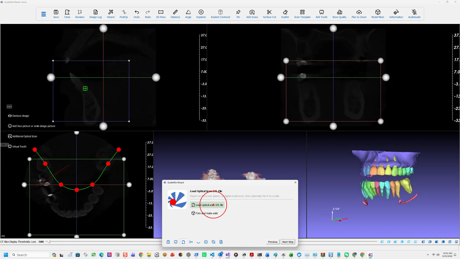 Load optical scan STL file