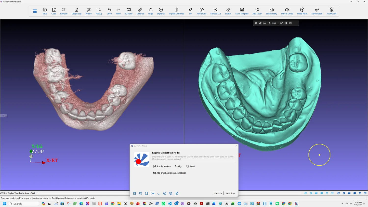 The same scan, occlusal view
