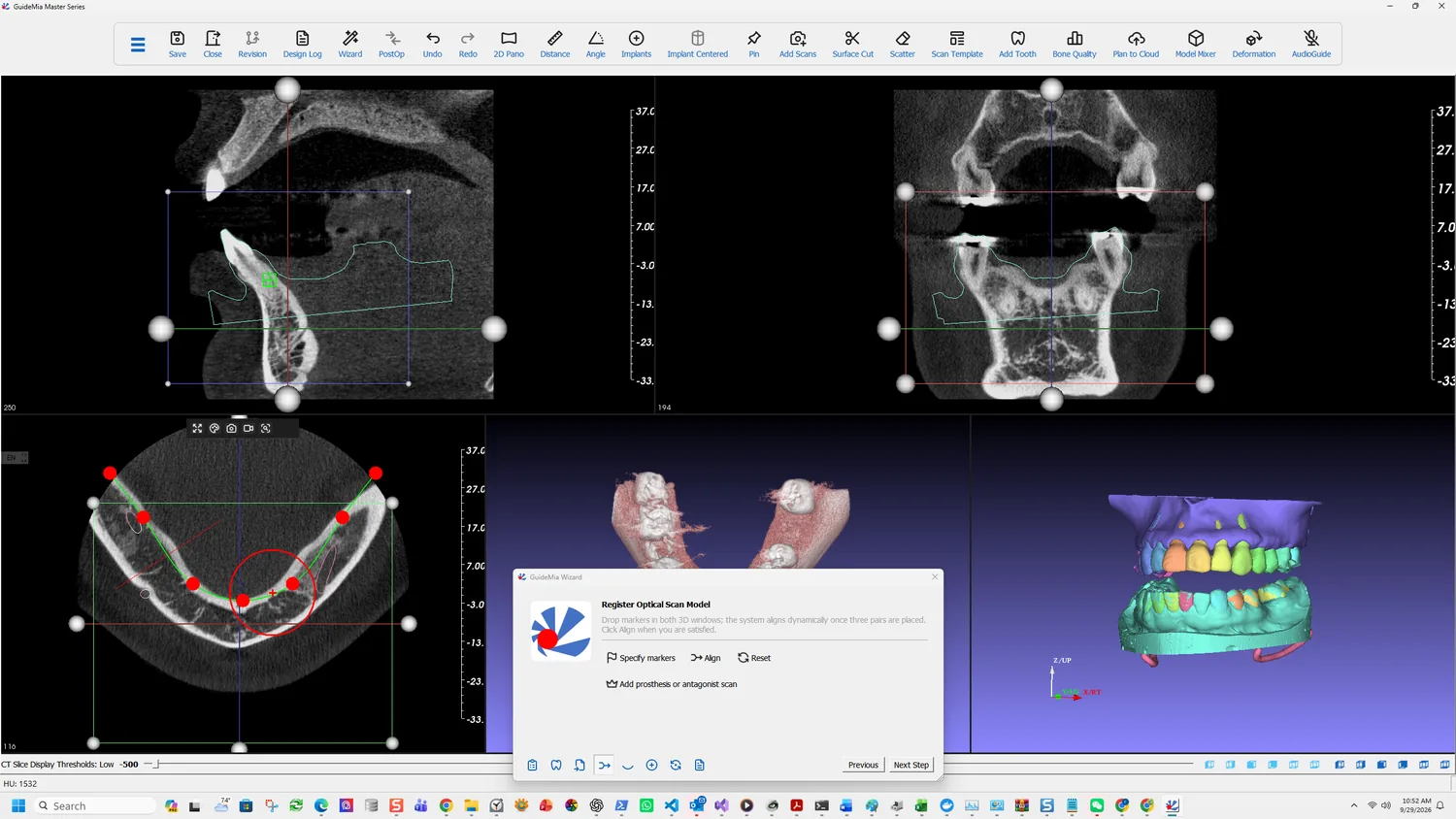 The scan outline drawn over the CT slices