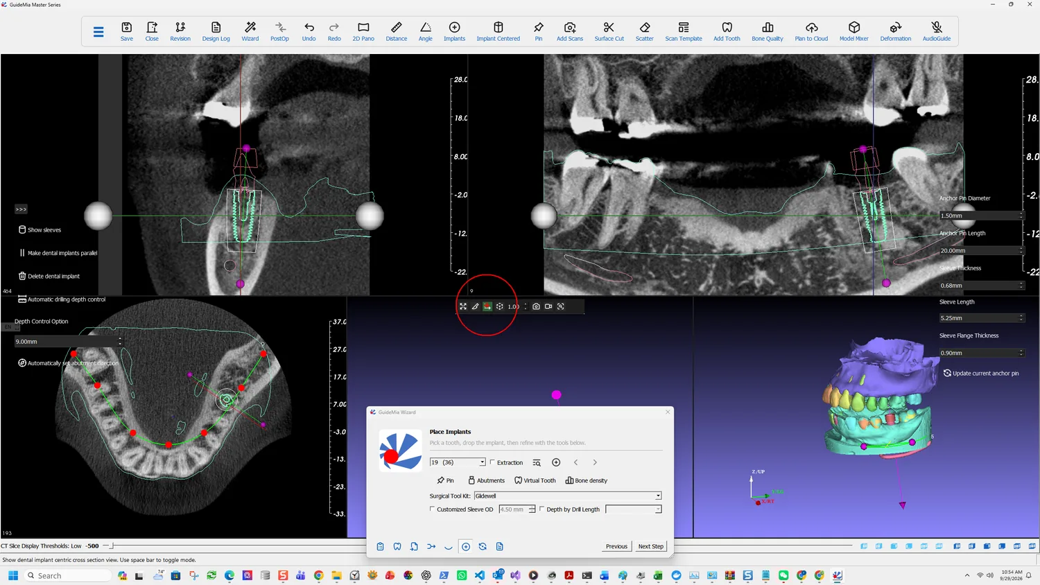 The implant-centric cross section