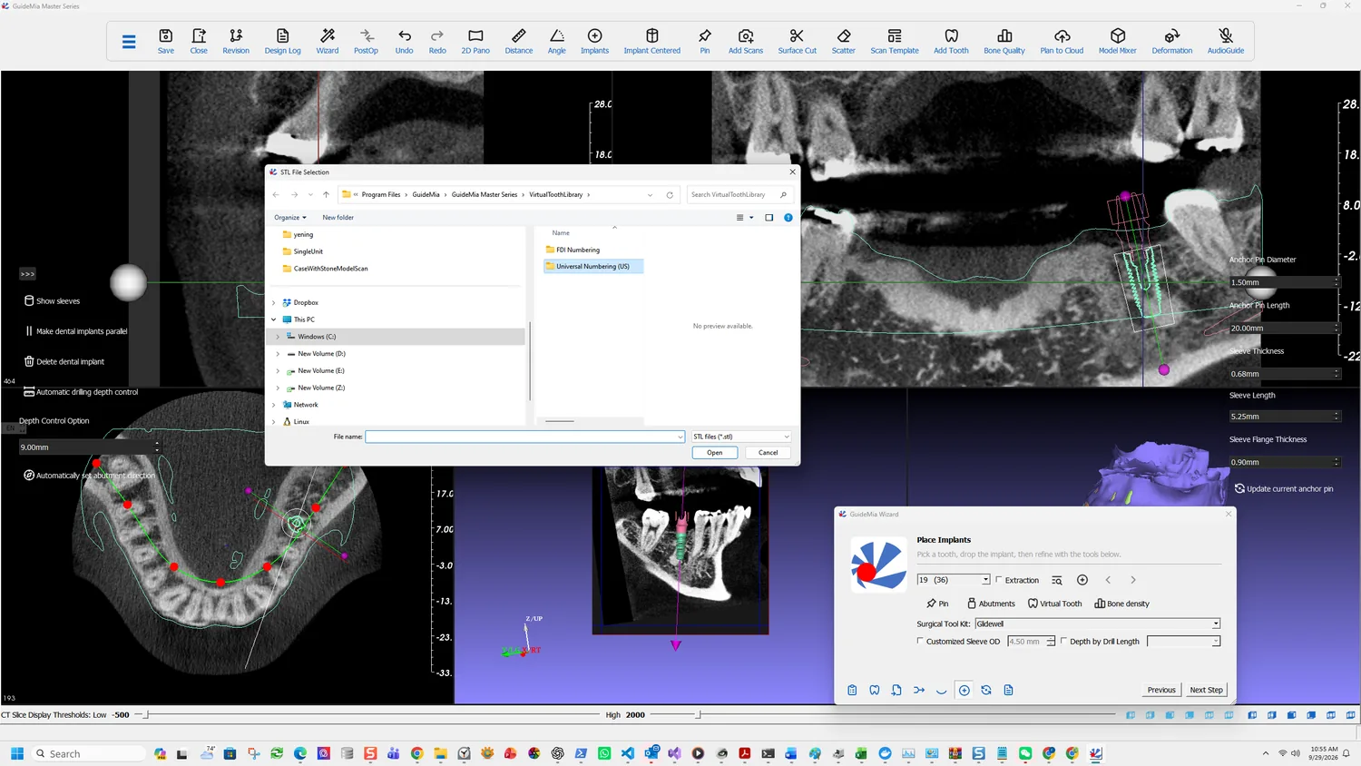 Selecting a tooth model