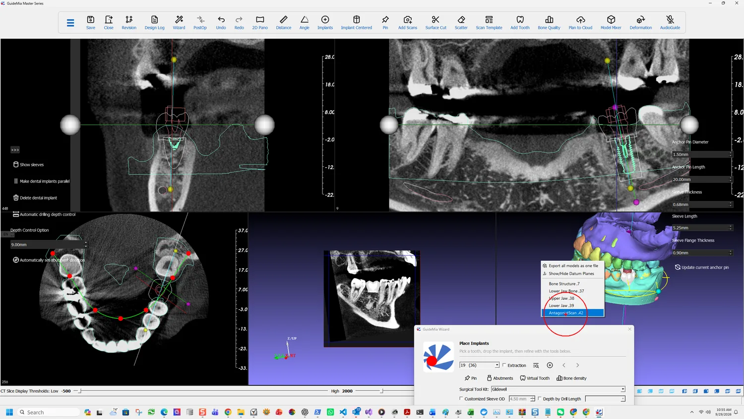 The antagonist scan shown against the plan