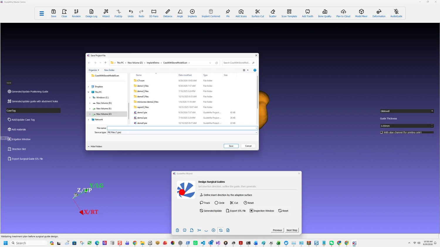 Saving the project file