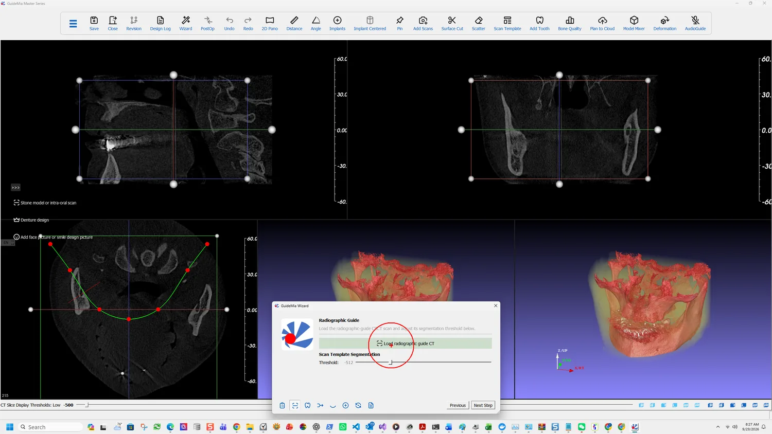 The Radiographic Guide page, with the scan template threshold