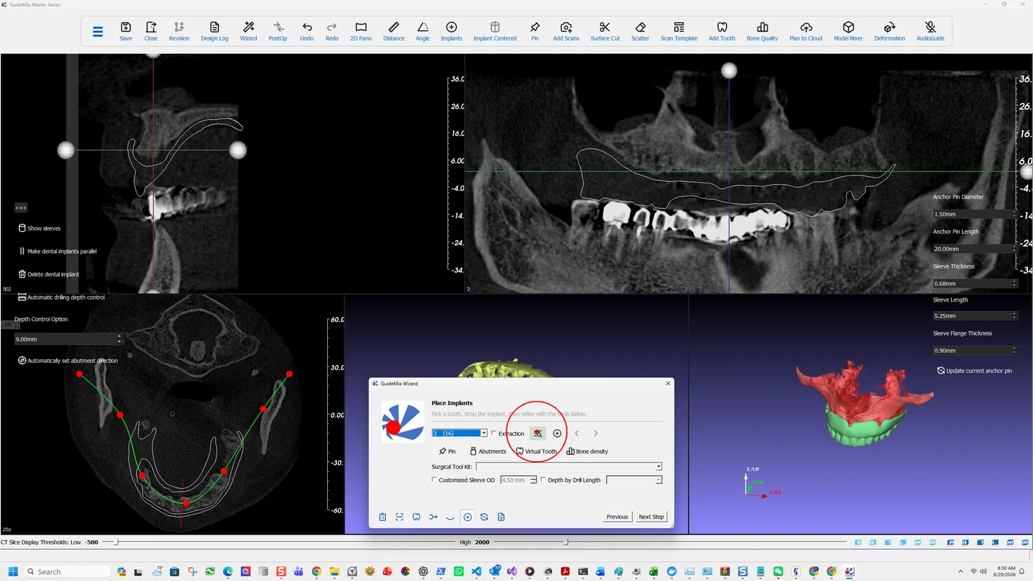 Browsing the implant library