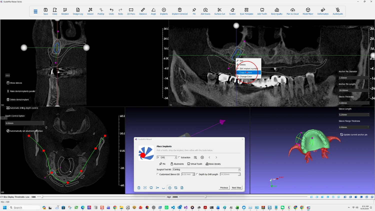 Copy Implant on the right-click menu