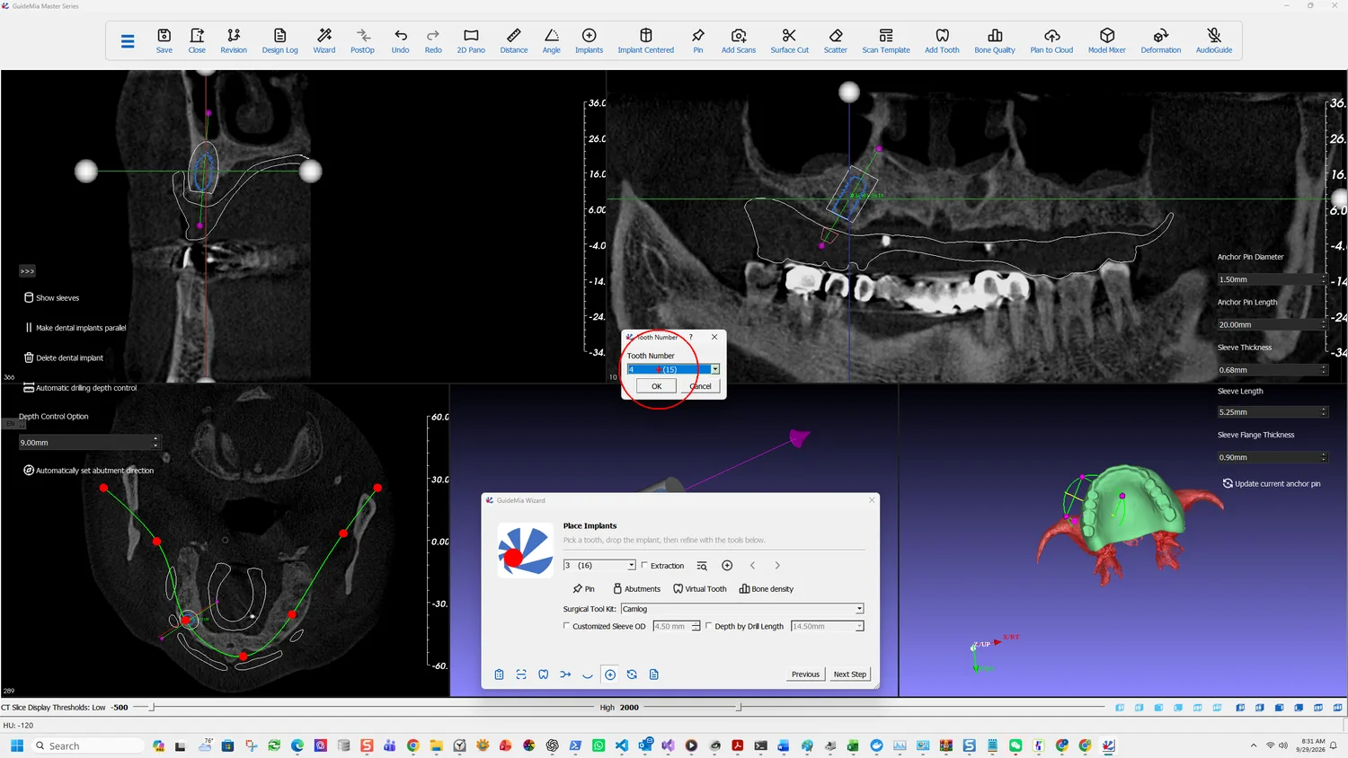 The Tooth Number dialog