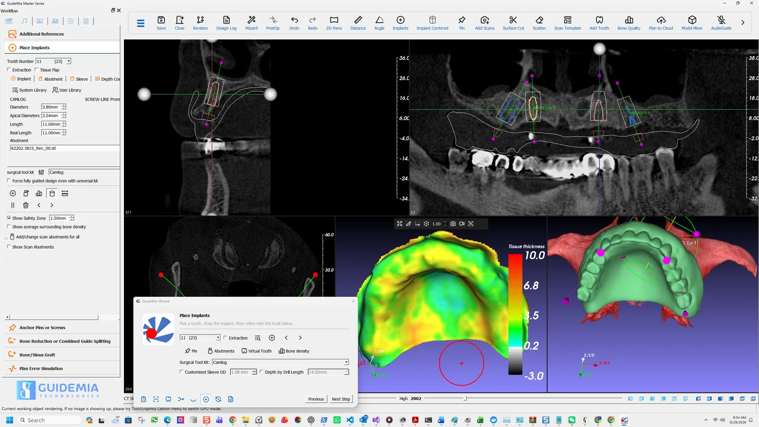 The tissue thickness map over the palate