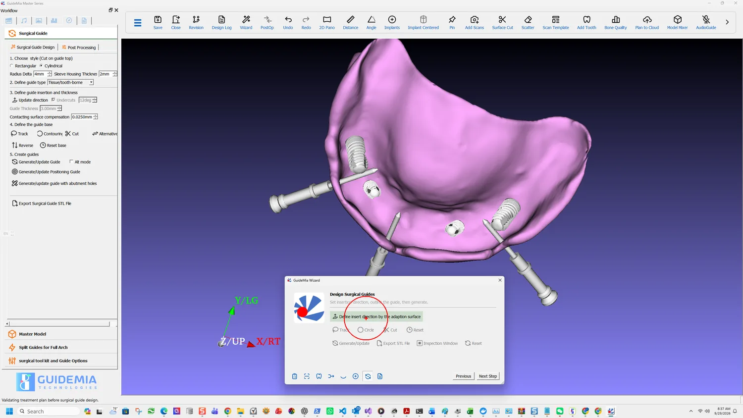 Setting the insertion direction