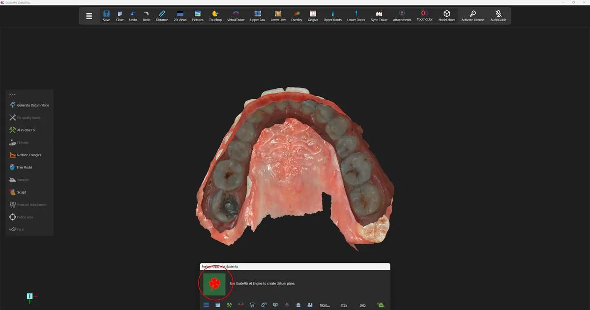 The upper jaw alone, with the Happy Button standing on the occlusion plane step.