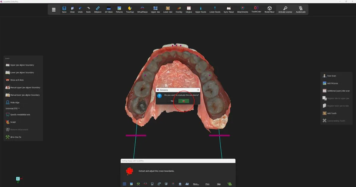GuideMia offering to evaluate the occlusions before the plane is settled.