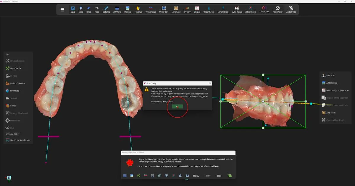 The scan-quality report, naming the teeth that need watching.