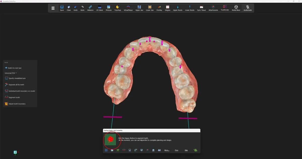 The upper arch from below, ready for mesial-distal axes; the short magenta bars are the axes already recognised.