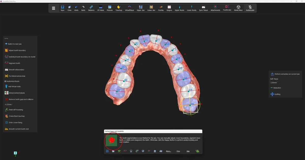 The upper arch separated: each crown its own object, numbered, in alternating colours, with its axes drawn on it.