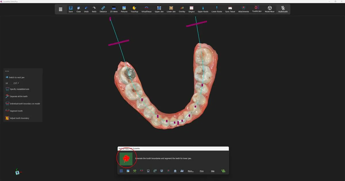The lower arch, with the tooth-number control now at tooth 18 (FDI 37) and the arch curve and its range bars visible.