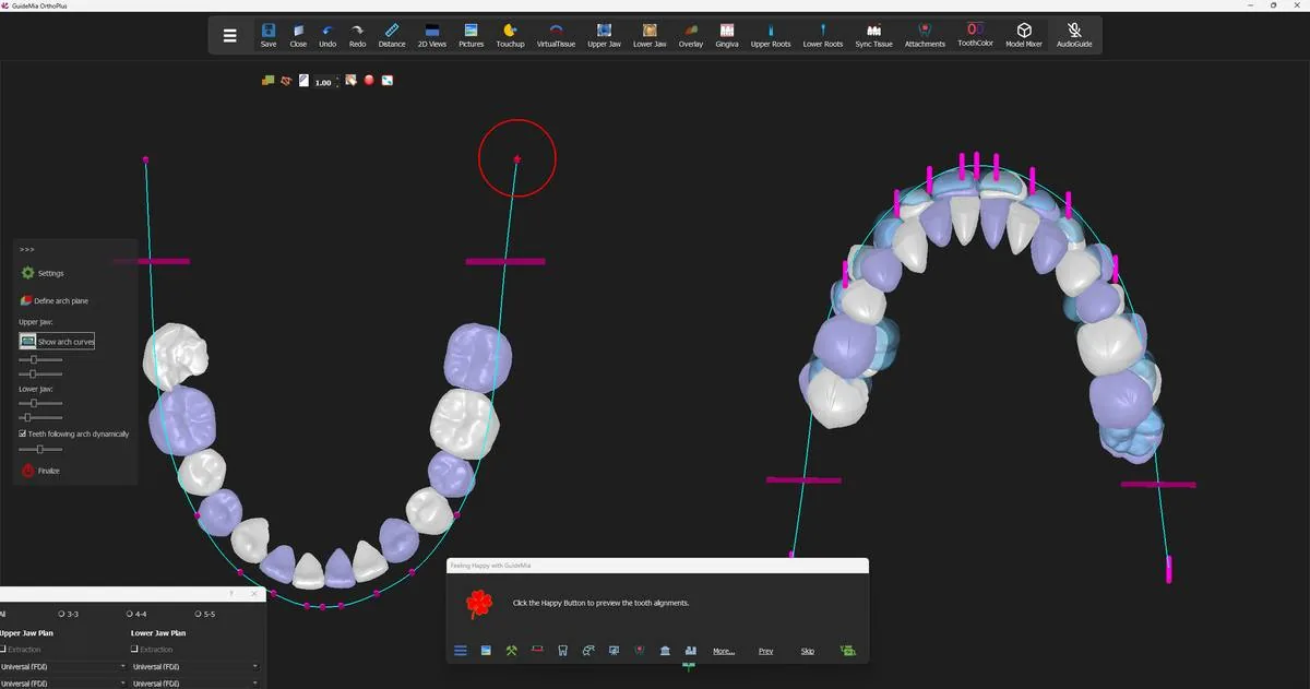 The proposed positions previewed against the arch curve, with the starting positions still visible behind them.