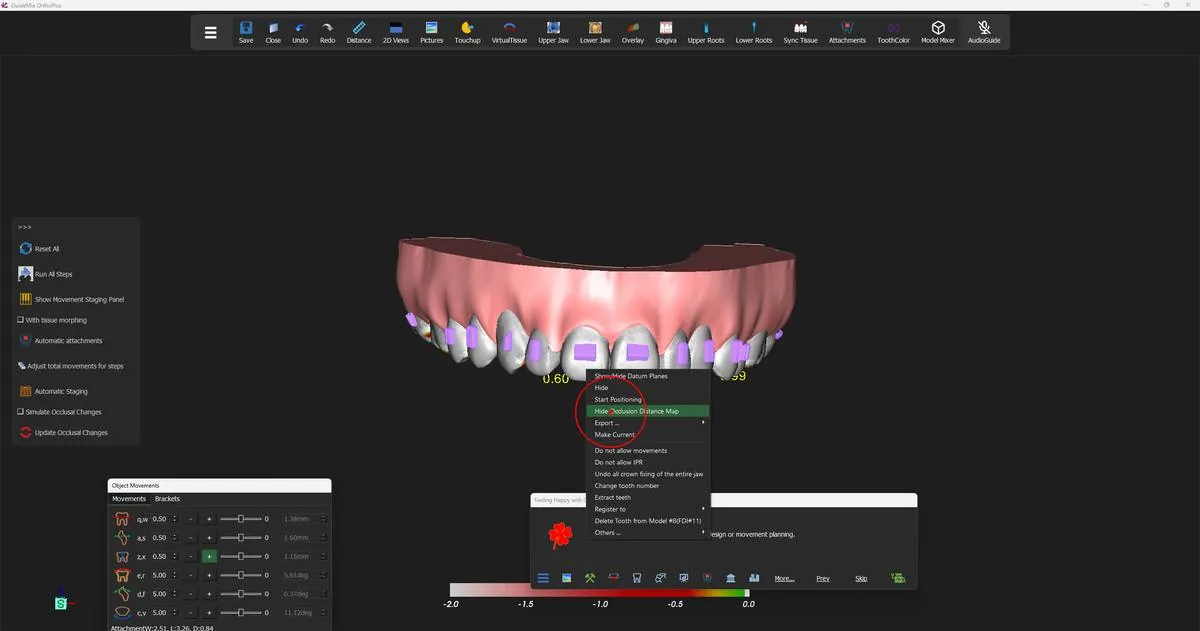 Turning the occlusal distance map off again from the same menu.