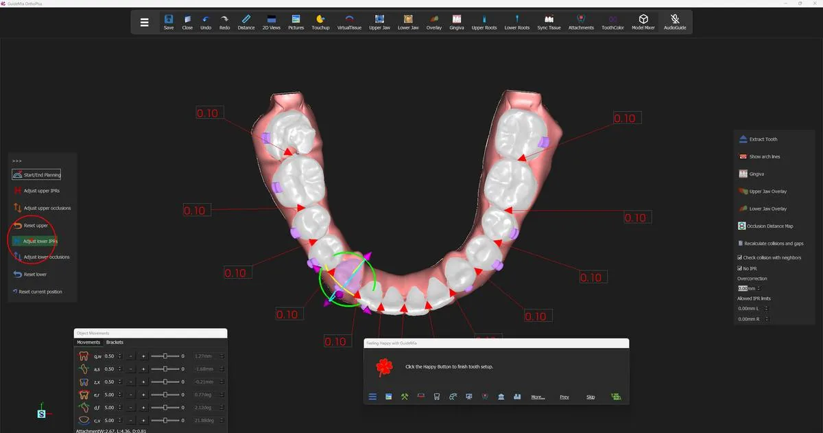 The same arch after re-running the IPR adjustment.