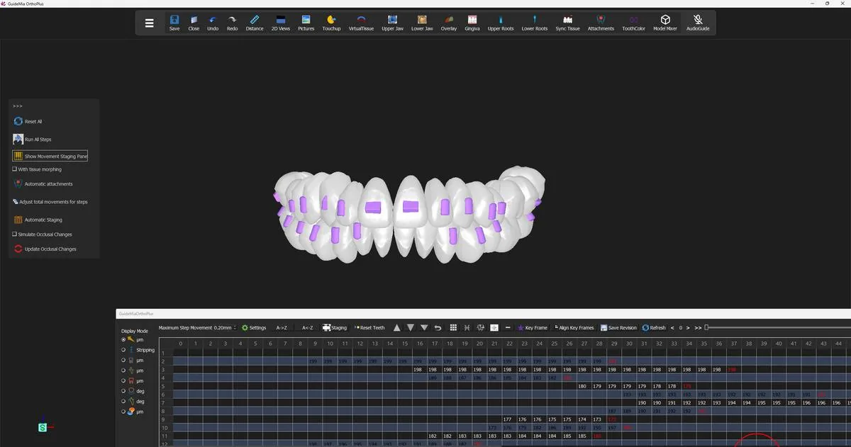 The movement table: rows are teeth, columns are steps, red text marks key frames.