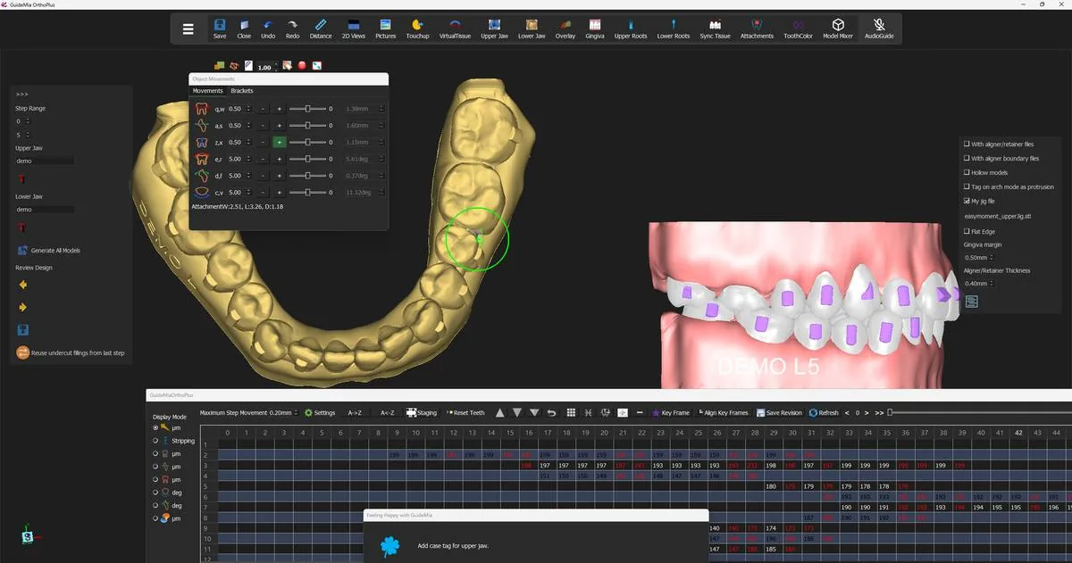 A generated lower arch model from the occlusal, with the interproximal fillings visible between the crowns.