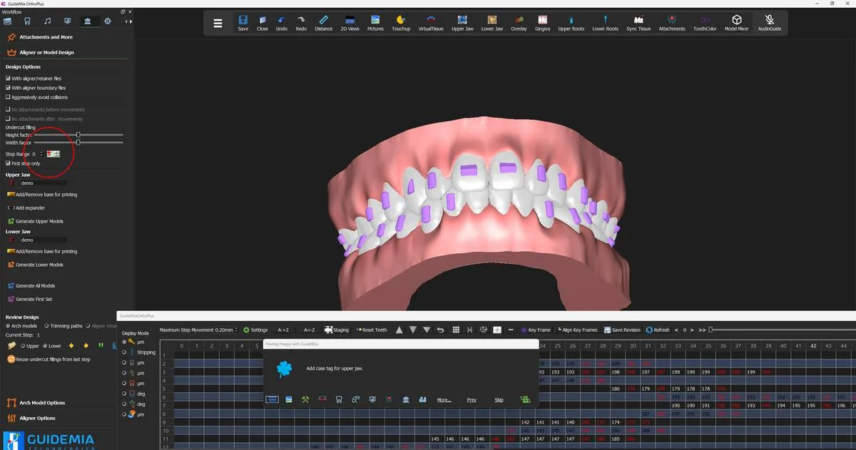 The design page in aligner mode: the aligner/retainer option ticked, the attachment-timing options greyed out.
