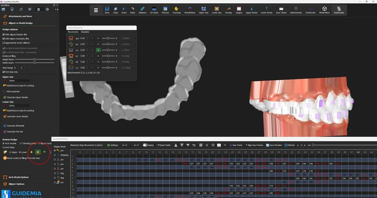 The same aligner from the occlusal, showing the margin all the way round the arch.