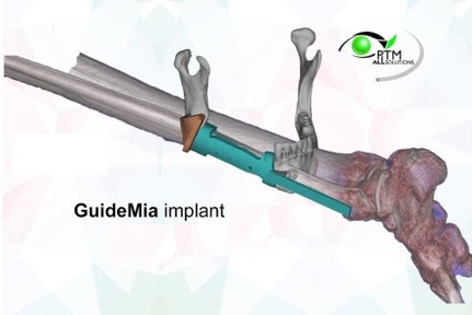 Más allá de los implantes — aplicaciones clínicas adicionales