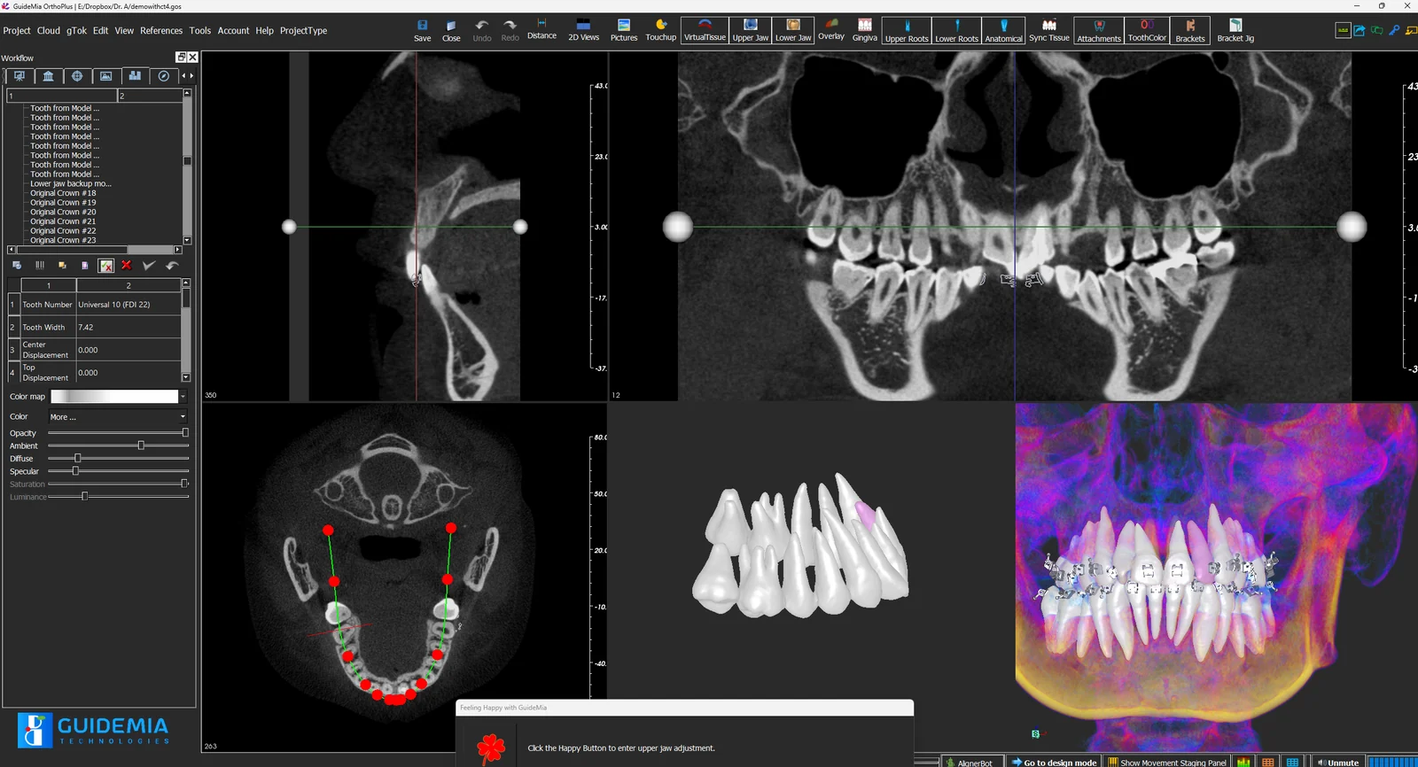 Captura de pantalla de GuideMia OrthoPlus