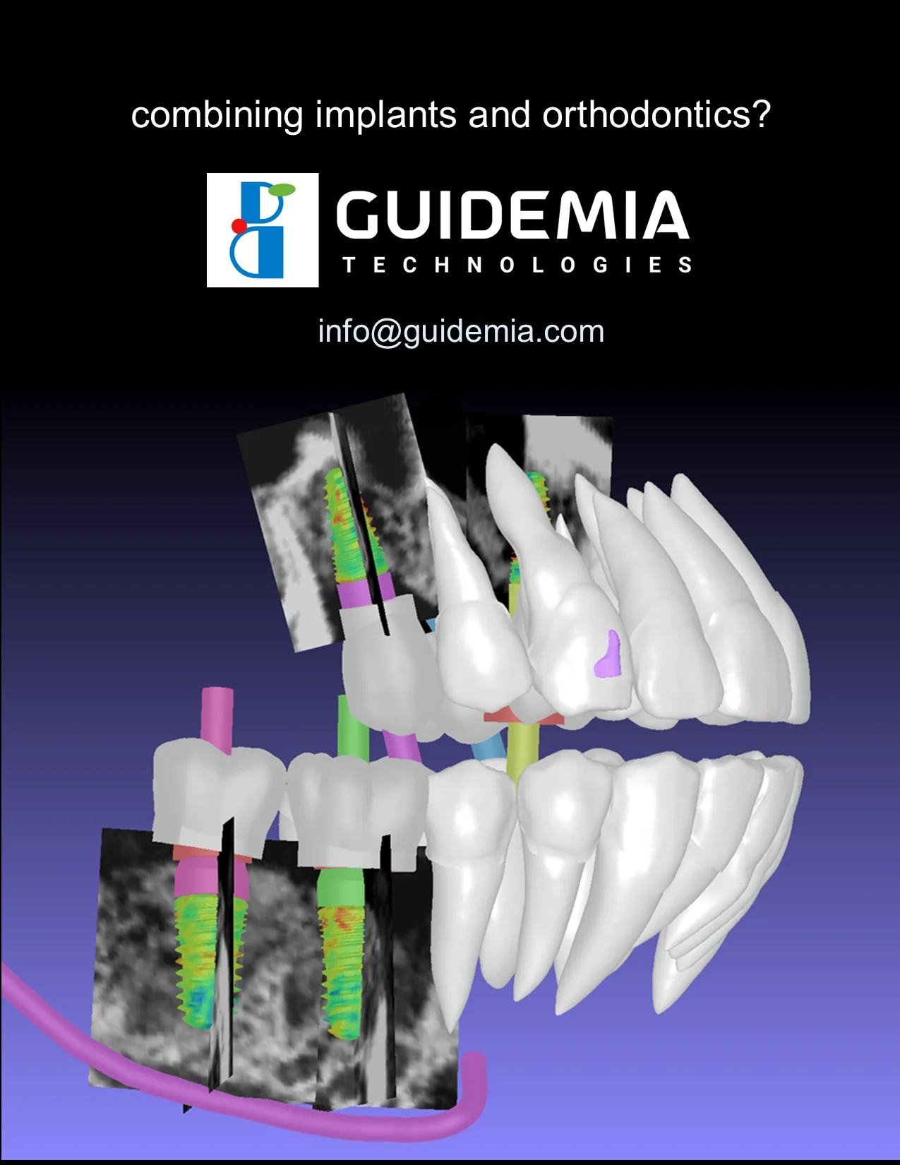 Comparativa entre OrthoPlus y OrthoClic