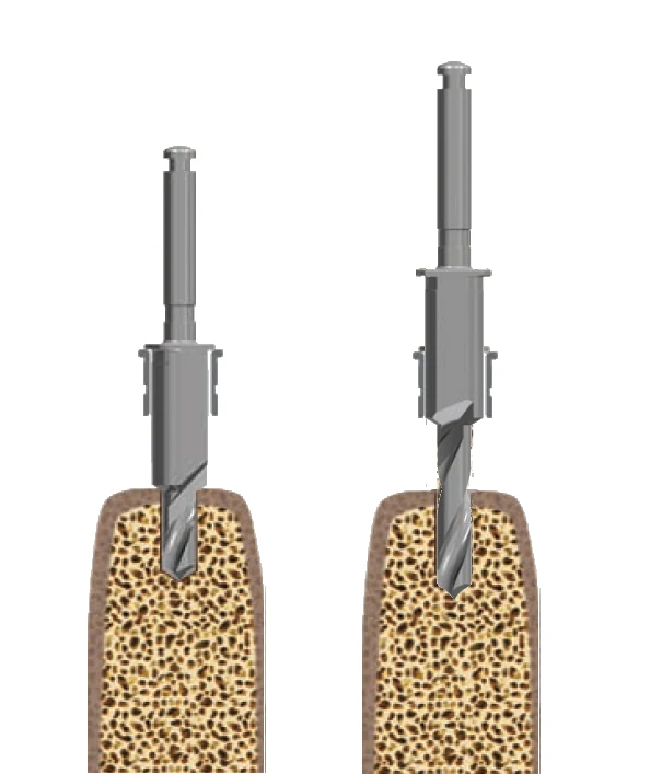 Two-step drilling: the short drill opens the hole, the longer one follows it down